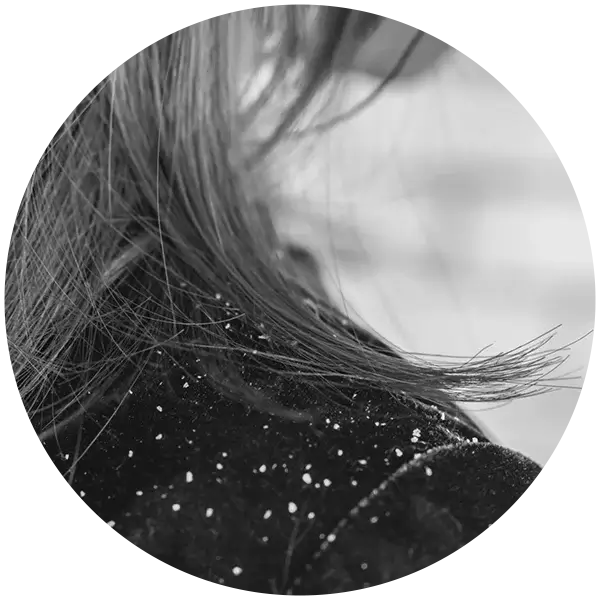 HairShield-Blue-Shampoo-Dandruff